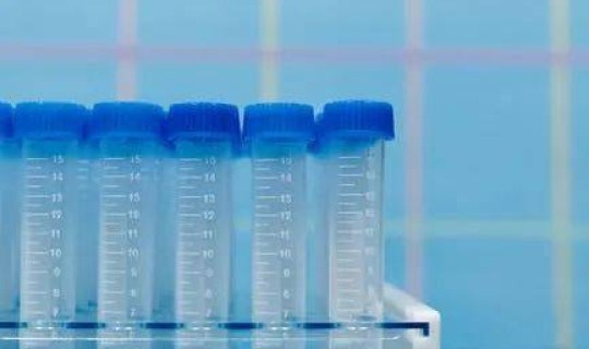 福田核酸检测多久出结果(核酸检测是什么意思)