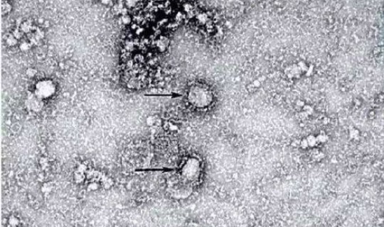 明年新型冠状病毒会重现吗，新型冠状病毒为什么突然消失了