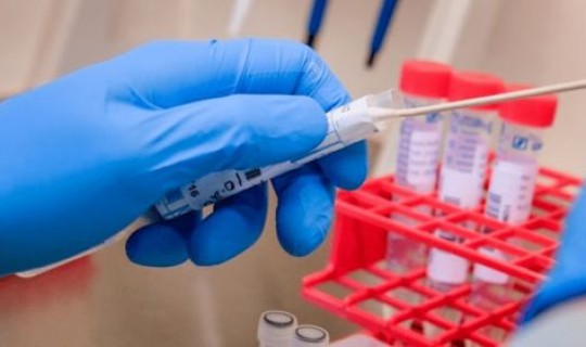 核酸检测日期可以改吗？b族链球菌核酸检测是查什么