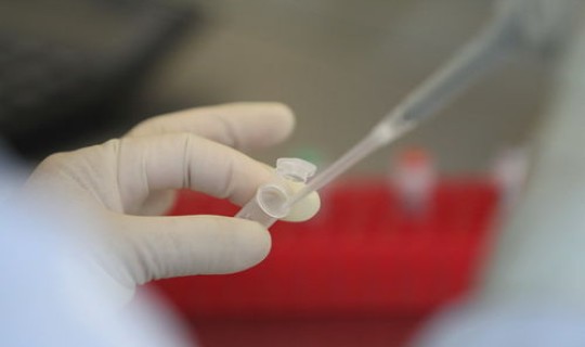 被隔离核酸检测是阴性还用隔离吗，b族链球菌核酸检测是查什么