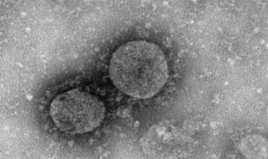 扬州一例新型冠状病毒 2019新型冠状病毒