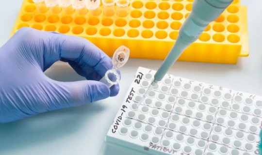 核酸检测结果显示未检测 hiv核酸检测多久出结果