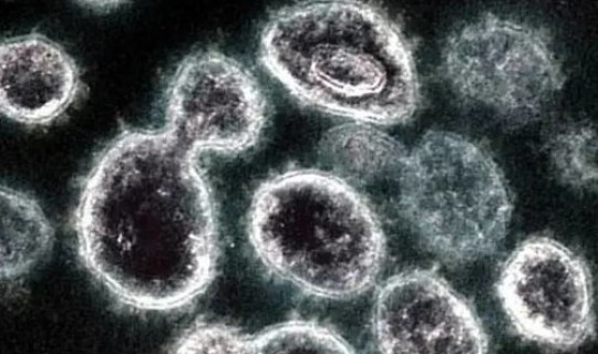 中国 新冠肺炎死亡率？肺炎会死人吗