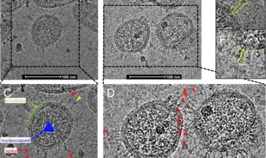 新冠病毒出现最早时间，冠状病毒肺炎