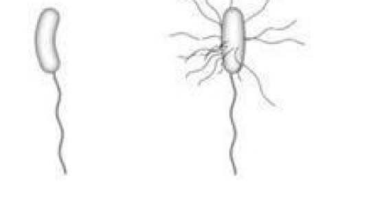 还有霍乱吗?霍乱古代叫什么病 还有霍乱吗?霍乱古代叫什么病