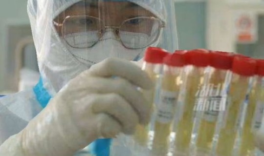 河南核酸检测要求几天(病毒核酸检测)