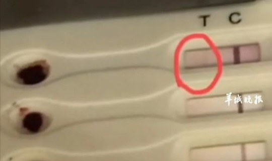 石家庄出现阳性 hiv阳性