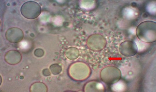 核酸阳性率最高的是哪个，沙眼衣原体核酸检测阳性