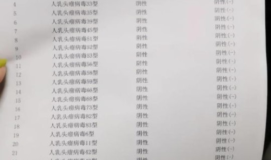 多地检测出阳性 检查结果阴性好还是阳性好