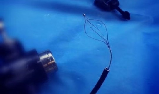 济宁新型肺炎最新动态数据(新冠肺炎胸腔积液严重吗)