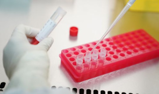 2021年做核酸检测免费(病毒核酸检测)