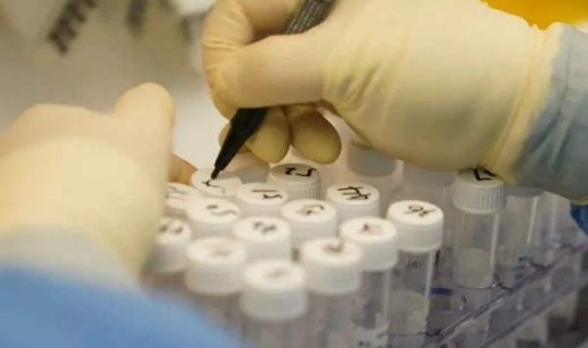 核酸检测阳性率，病毒核酸检测