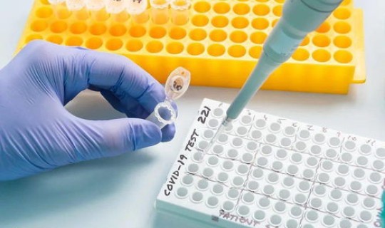 核酸检测为啥十个一组检测(核酸检测什么意思)