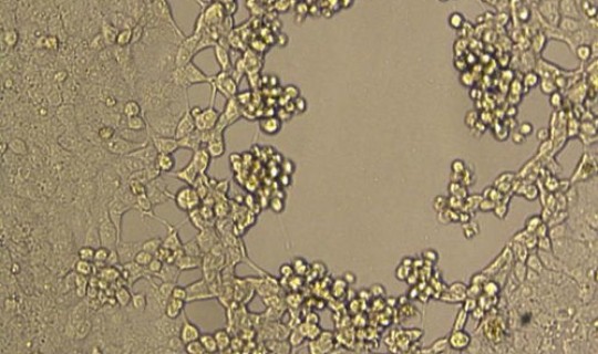 嘉兴有几例新型冠状病毒，宁波新型冠状病毒