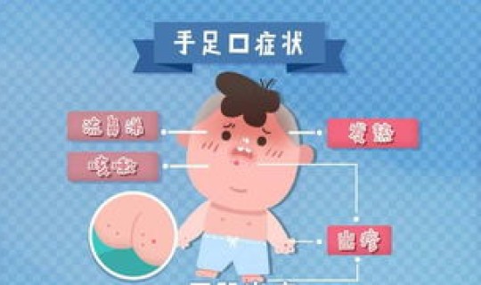 成都发现新病毒最新消息7月23 成都最近爆发的传染病 成都发现新病毒最新消息7月23 成都最近爆发的传染病