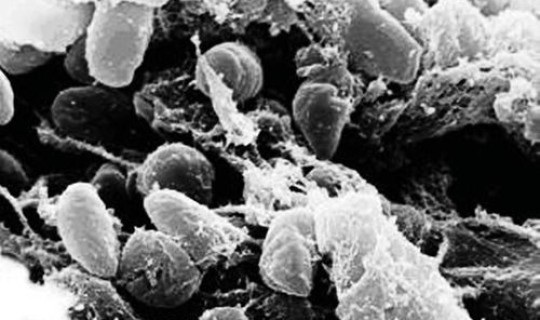 鼠疫害死多少人(鼠疫就是黑死病吗)