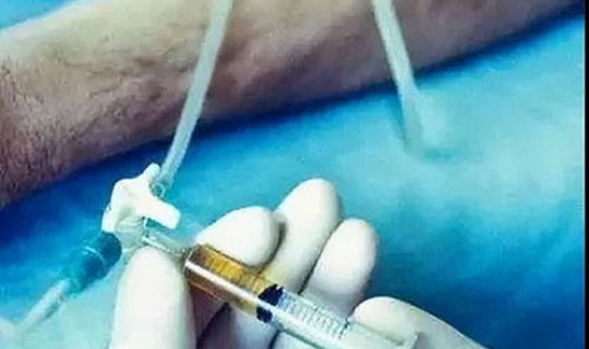 中国何时开放安乐死？安乐死原理