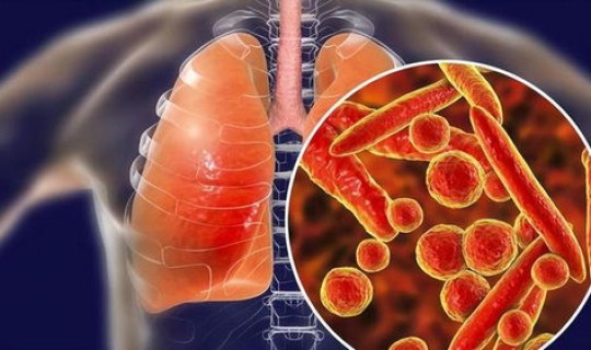 无症状新冠肺炎传染性强吗？新型肺炎的症状有哪些症状