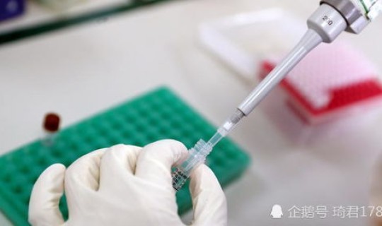 无症状感染者传染几率有多大(无症状感染者是什么)