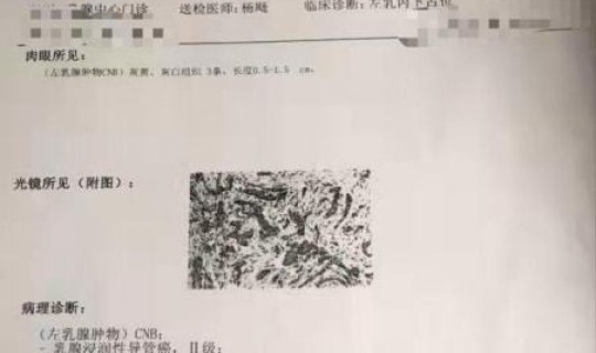 石家庄确诊病例情况查询？石家庄居民健康网