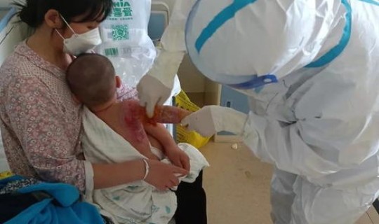 吉林有没有新型肺炎，吉林省肺炎在哪个城市