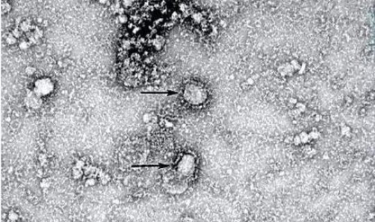 苏州现在有病毒吗(武汉还有病毒吗)