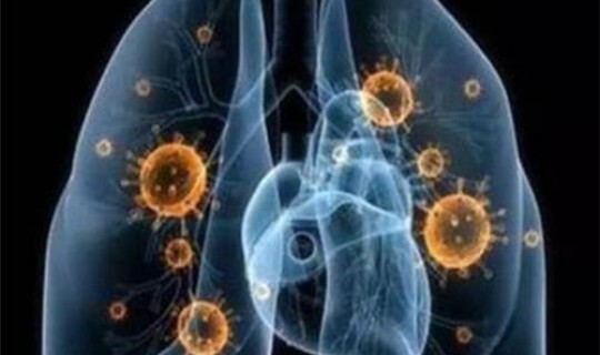 英国的新冠肺炎情况，冠状肺炎