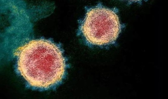 新冠病毒哪里最严重?冠形病毒如何引起的 新冠病毒哪里最严重?冠形病毒如何引起的