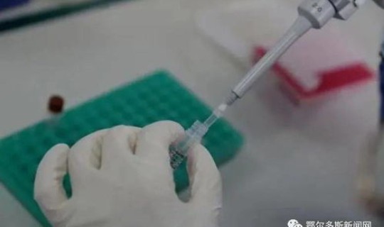 内蒙古核酸价格 核糖核酸价格是多少