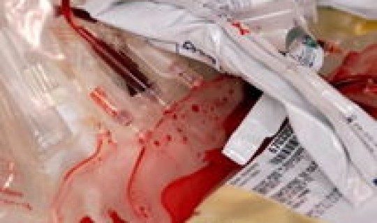 美国感染了多少？美国艾滋病感染者数量