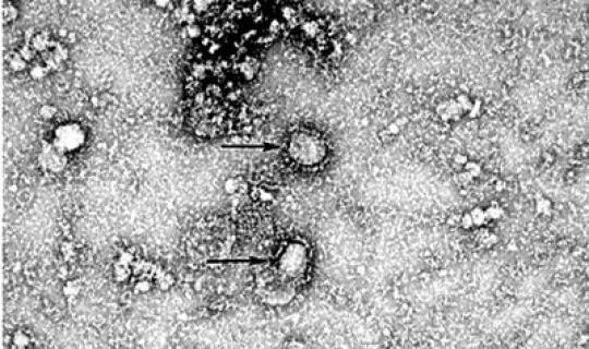 山东青岛新型冠状病毒最新消息 新冠病毒最新情况