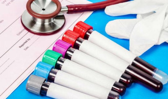 北京检测出59例阳性，女性高危59阳性能自愈吗