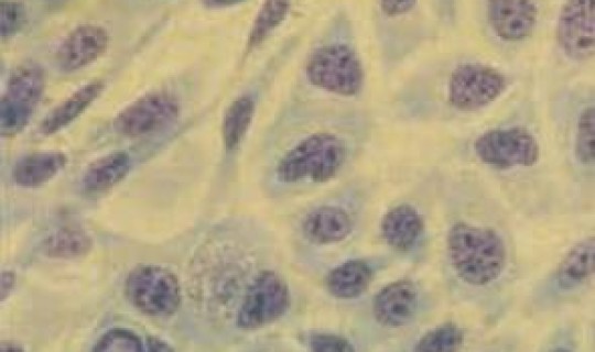 跟核酸阳性接触会感染吗？沙眼衣原体核酸检测阳性