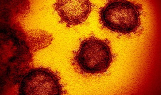 第一个感染新冠肺炎者是谁(冠状病毒感染性肺炎症状)