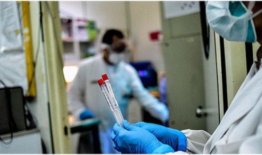 疫情为何还没有疫苗 疫情以后还会发生吗