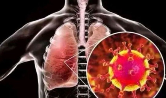 104人感染，人冠状病毒感染传播途径