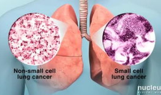 苏州目前有新型冠状病毒吗多少例？苏州最近流行的病毒