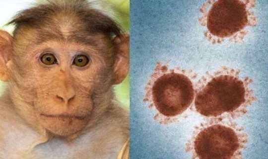 首例感染猴b病毒死亡(猴痘病毒)