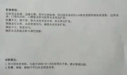郑州新增确诊病例155例？郑州艾滋病患者名单