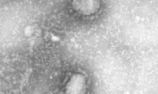 湖南新型冠状病毒最新情况消息 冠状病毒怎么来的