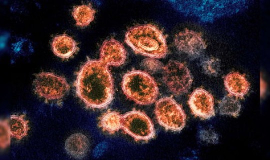 英国新冠肺炎感染人数，英国艾滋病感染率