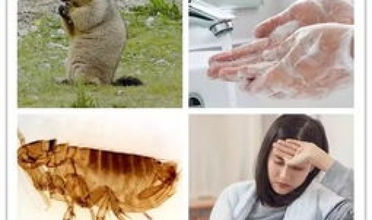 鼠疫的病死率是多少(有鼠疫的老鼠能活多久)