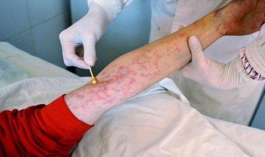 黑龙江最新感染情况，黑龙江多少艾滋病患者