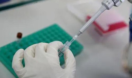 河南核酸检测要求(核酸检测hiv有没有意义)