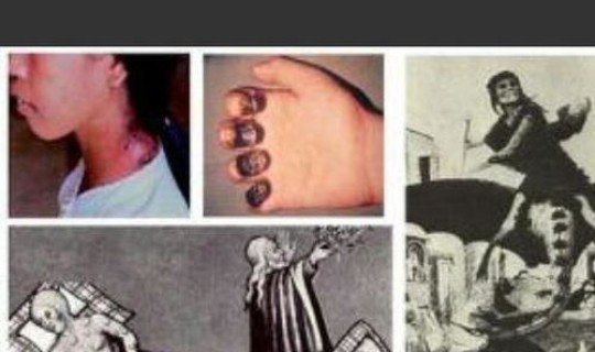 鼠疫最多一次死了多少人 鼠疫的症状会死人吗