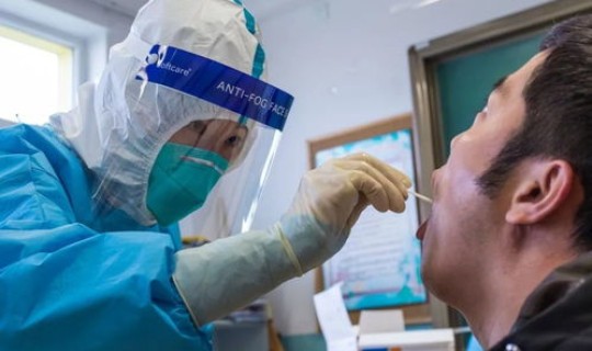 核酸检测北京免费吗？北京hiv核酸检测医院