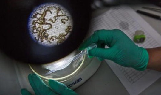 英国新型冠状病毒死亡率是多少 埃博拉病毒死亡率是多少