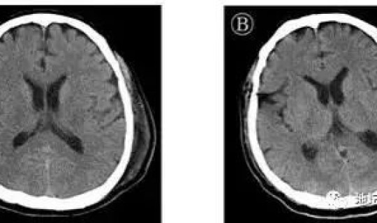 北京新冠病毒肺炎最新消息，最新肺炎病毒感染