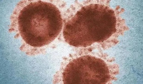 莆田确诊一例新型冠状病毒，新型冠状病毒是新冠病毒吗