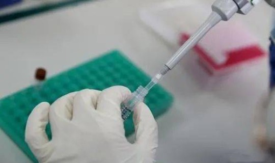 上海 核酸检测 免费吗最新 核酸检测hiv